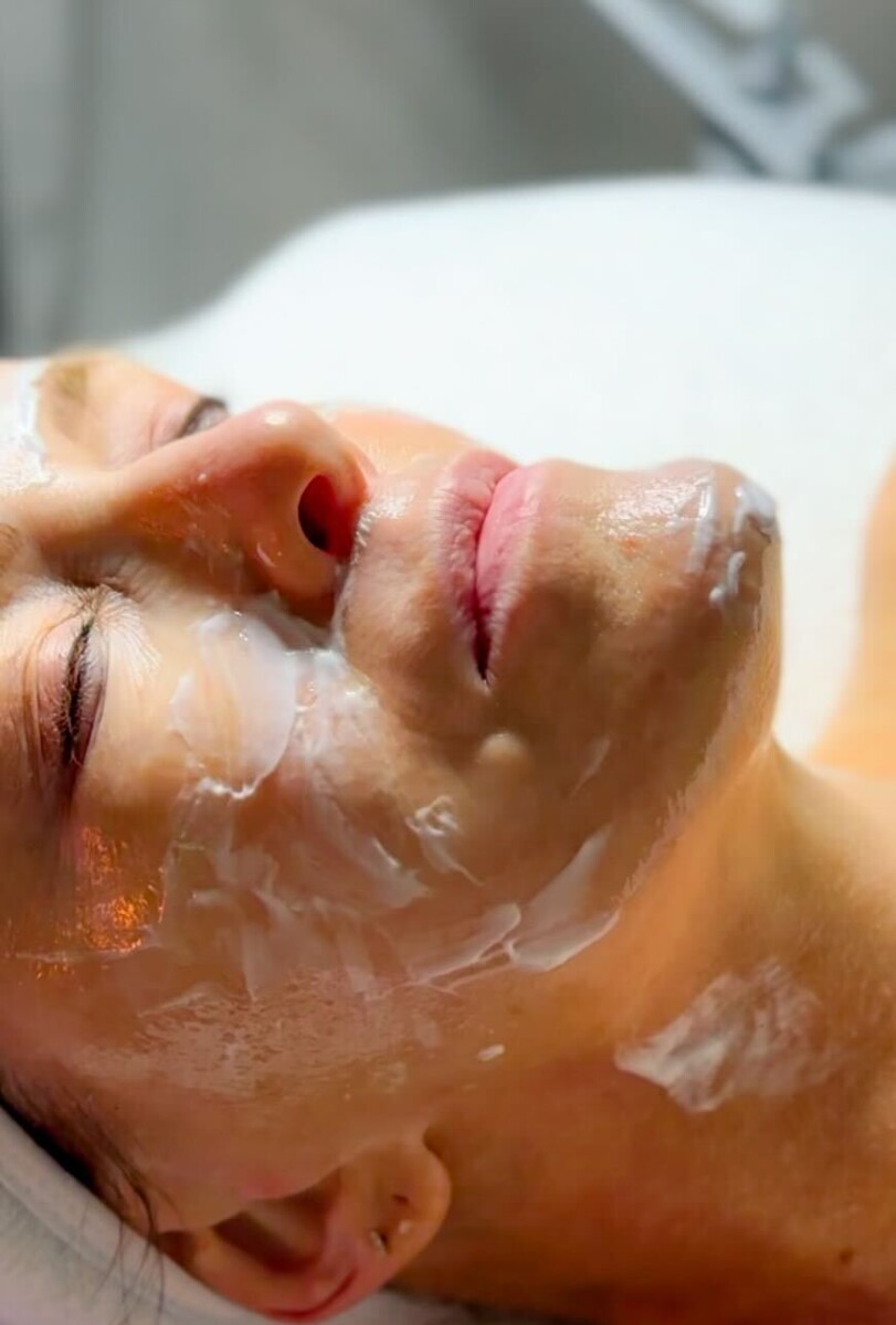 Jamie Tarence of Family Savvy during a microneedling treatment from MyRainberry holistic spa